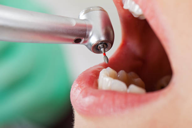 Best Broken Tooth Emergency  in Endicott, NY
